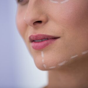 Jawline Contouring